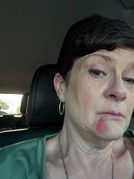 With my POTS I have very low blood pressure. This morning I forgot to take  my medication that increases my blood pressure. Unfortunately I ended up  passing out in my driveway.