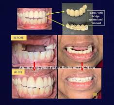 Klinik Pergigian Pakar Restoratif Dr. Mera - Dental Specialist Clinic Ipoh (Root Canal, Implant, Crowns, Bridge, Braces)