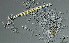 Image result for Raphidiocystis