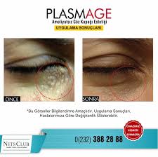 Goz Kapagi Estetigi Saglikli Gorme Alani Yakalamak Icin Goz Ust Kapaginda Sarkan Fazla Deri Fazlasinin Ve Yag Dokusu Fazlasinin Alinm Anti Aging Skin Aging