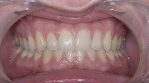 Que faire à la maison? Les Signes Qui Doivent Alerter Les Parents Dr Eric Ursat Orthodontiste A Strasbourg 67000