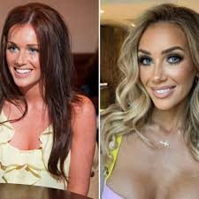 Love Island stars' changing faces