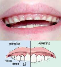 Teeth Grinding At Night Worms Crawling In The Belly What Should I Do If My Child Grinds His Teeth While Sleeping Is There Really A Bug Daydaynews