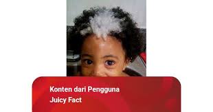 Tanda Lahir Anak Ini Mendapatkan Perhatian Pengguna Internet