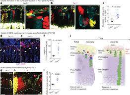 The Presence Of An Epiphyseal Line Indicates That (A) Epiphyseal Growth Has  Ended. (B) Epiphyseal Growth Is Just Beginning. (C) Growth In Bone Diameter  Is Just Beginning. (D) The Bone Is Fractured
