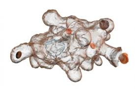 Häufige darmbewegungen mit weichem, wässrigen stuhl (durchfall), übelkeit, erbrechen, schmerzen, appetitlosigkeit. Amobenruhr Ursachen Symptome Behandlung Medlexi De