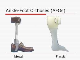 To secure the brace, all you do is close the dial down and turn it until the. Ankle Foot Orthoses Afos Ppt Video Online Download