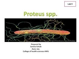 Vi brinner för att göra tjänstepension enkelt för både privatpersoner och företag. Proteus Spp Lecture