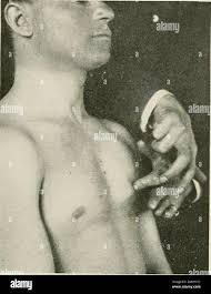 The mid axillary line hi-res stock photography and images