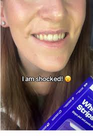 Affordable Teeth Whitening Hacks You Must Try