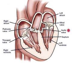 Pin On Heart Valve