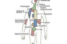 Dercum Disease Life Expectancy Dercum S Disease