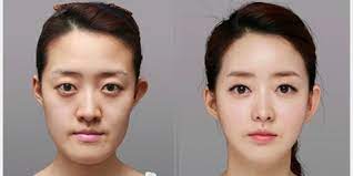 Artis Senior Bicara Ini Bukti Artis Korea Pilih Operasi Plastik Kapanlagi Com