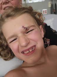 Grateful for the help at Ocean Baths entrance