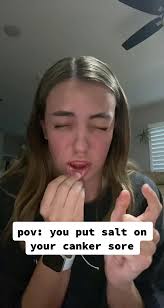 Canker Sore Pain Relief: Salt and Water Remedy