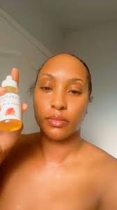 Thank you, beautiful Trish @_trishhoney, for glowing with our Vitamin A  Serum! ✨Say hello to your new skin savior 💧This gentle yet powerful  formula helps balance oil, boost collagen, fade acne scars, ...