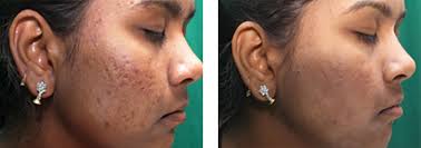 Dr. Ashima Goel, Dermatologist