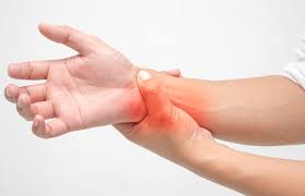Ketahui Apa Itu Carpal Tunnel Syndrome Cts Dan Cara Mengatasinya The Malaya Post
