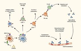 Image result for Transplant Rejection