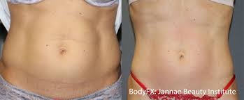 Pin On Treatments We Offer