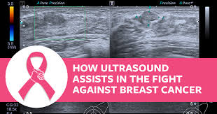 Can be idiopathic, related to steroid abuse or associated with hormonal treatments such as prostate cancer therapies. Breast Ultrasound And How It Is Used To Fight Against Breast Cancer Wcui