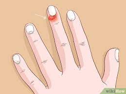 How To Care For Your Nails: 10 Steps (With Pictures) - Wikihow