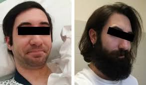 Flat chin, shape, nose, cheekbones, sharp, prominent, wide, face shape, jaw, big, huge, no surgery, makeup, contouring, haircut, hair,. 7 Ways To Hide A Weak Jawline Double Chin With A Beard