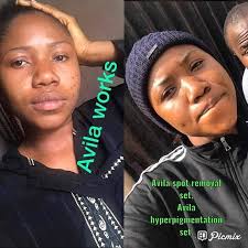 Skin Care Solution Abuja (@dublishop_international) · Instagram 照片和视频