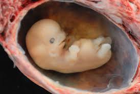 Check spelling or type a new query. Week 8 Of Pregnancy Week By Week Pregnancy Calendar Parenting Patch