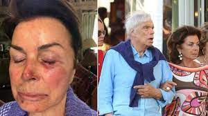 Tapie was born in paris. Bernard Tapie Et Son Epouse Tres Violentes Les Details Glacants De La Terrible Agression Devoiles