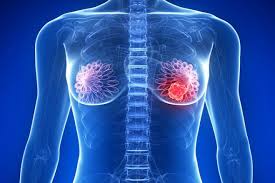 Mama's guide recipes is all about recipes, homemade food, how to cook, everyday cooking, cookbook, meal preparation, cuisine, food blog, filipino food, pinoy recipes, lutong bahay. Las Mamas Trastornos Durante El Embarazo Y Despues