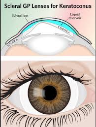 Image result for Sclera