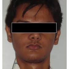 Intraoral photograph showing mandibular arch (Case 2).