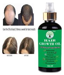 Minoxidil is a patented medication for hair regrowth, which means its effectiveness has received scientific evidence. Modern Ayurveda Onion Hair Growth Oil Hair Fall Control Hair Oil 100 Ml Buy Modern Ayurveda Onion Hair Growth Oil Hair Fall Control Hair Oil 100 Ml At Best Prices In India Snapdeal