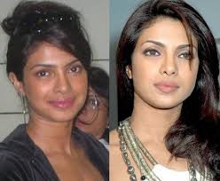 Priyanka Chopra Before And After Skin Lightening Lighten Skin Physical Beauty Celebrities Before And After