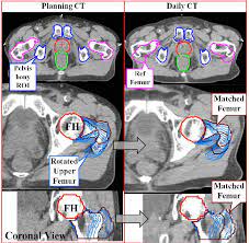 Check spelling or type a new query. Pelvic Bony Anatomy Used For Ct Registration Top Left And Imported Download Scientific Diagram