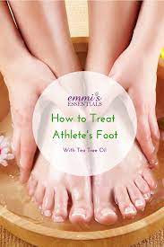 Pin On Diy Natural Remedies