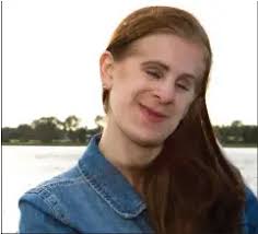 Rebecca blev født med cancer i øjnene