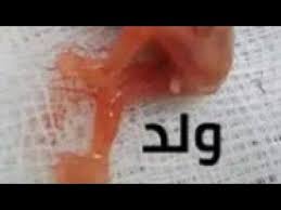 متى يبان نوع الجنين