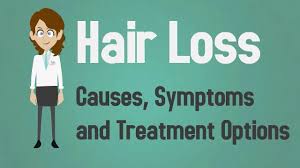 The majority of men will experience hair thinning or balding in their lifetime. Hair Loss Causes Symptoms And Treatment Options Youtube