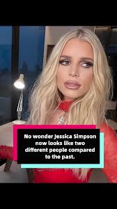 Josi Simson Vorher Nachher