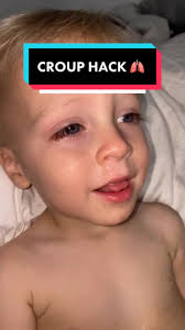 Image result for Croup