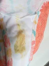 Es Normal Este Flujo Estoy Preocupada Club De Bebes Mayo 2020 Babycenter