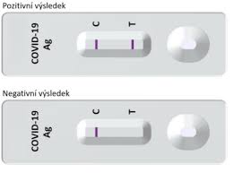 Proto test děláme opakovaně, uvedl. Llg Nabidne Na Svych Odberovych Mistech Nove I Antigenni Testy Pardubice Zive