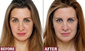 Some called the collagen supplement a these effects are well documented and have been known for a long time. How Long Before You See The Effects Of Taking Collagen