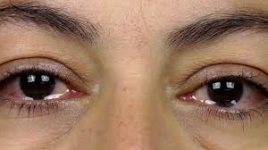 Check spelling or type a new query. Crying Woman Eye With Tears Stock Video Footage Storyblocks