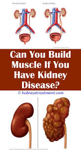 Polycystic Kidney Disease Mnemonic Kidney Disease Recipes Kidney Disease Symptoms Kidney Disease
