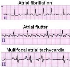 Pin On Cardiac