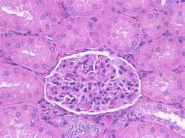 Preserved tissue was transplanted ectopically to mouse hosts and recovered xenografts were analysed histologically. Process Of Tissue Fixation The Nature Of Fixatives In Histology Leica Biosystems