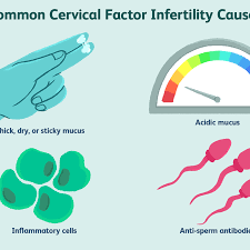 White discharge before period could mean various things. No Cervical Mucus Learn Why And What To Do